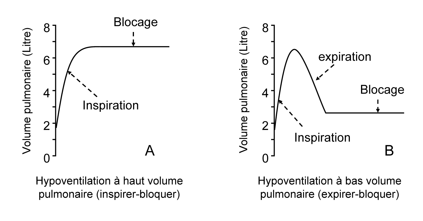 expirer bloquer